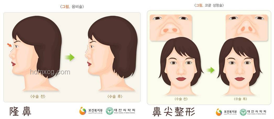 高鼻梁的秘密：解锁美的标准与自我认知之旅👃✨